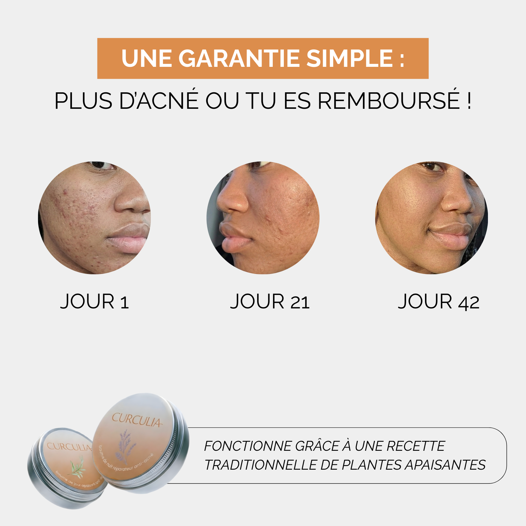 Baumes Apaisants Anti-Acné