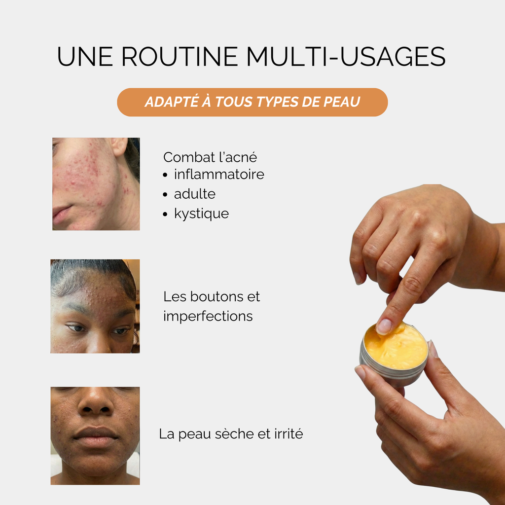 Baumes Apaisants Anti-Acné